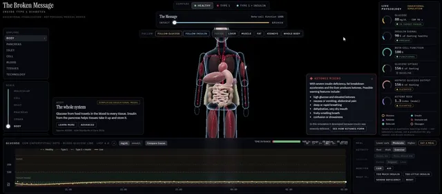 Interactive 3D Type 1 Diabetes Explainer